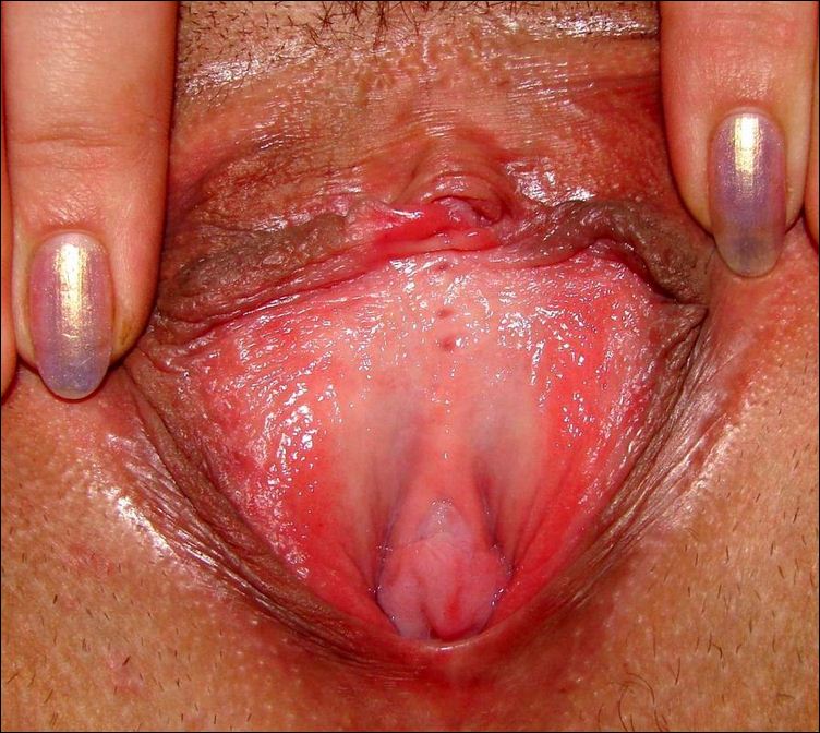 Небритая вагина с белыми выделениями фото